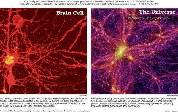 Brain cell and universe